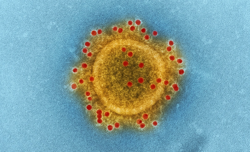 False: Coronavirus is like the flu