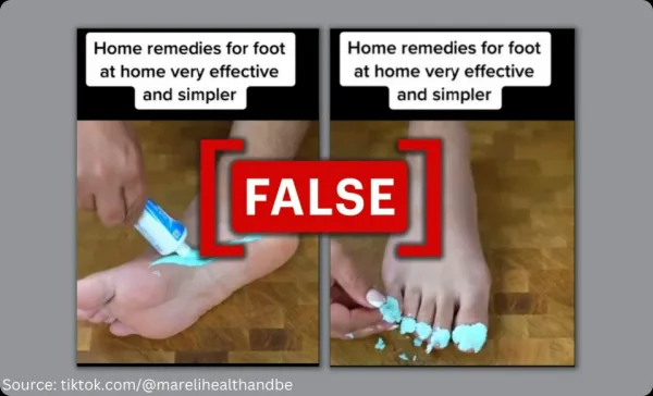 No scientific evidence that toothpaste can cure foot or toenail fungus